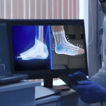 Medias De Compresión - Obtén Alivio Instantáneo De Pies